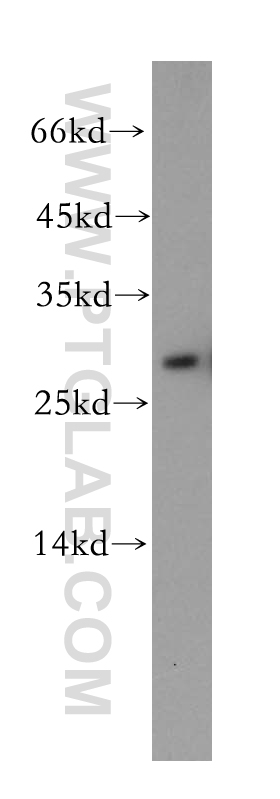 WB analysis of mouse brain using 18742-1-AP