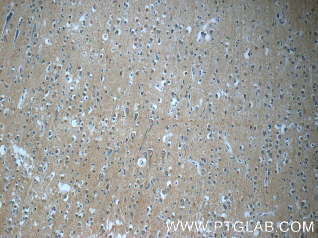 IHC staining of human brain using 25040-1-AP