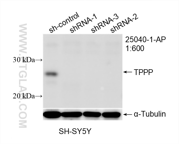 WB analysis of SH-SY5Y using 25040-1-AP