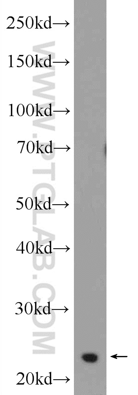 WB analysis of MCF-7 using 25040-1-AP