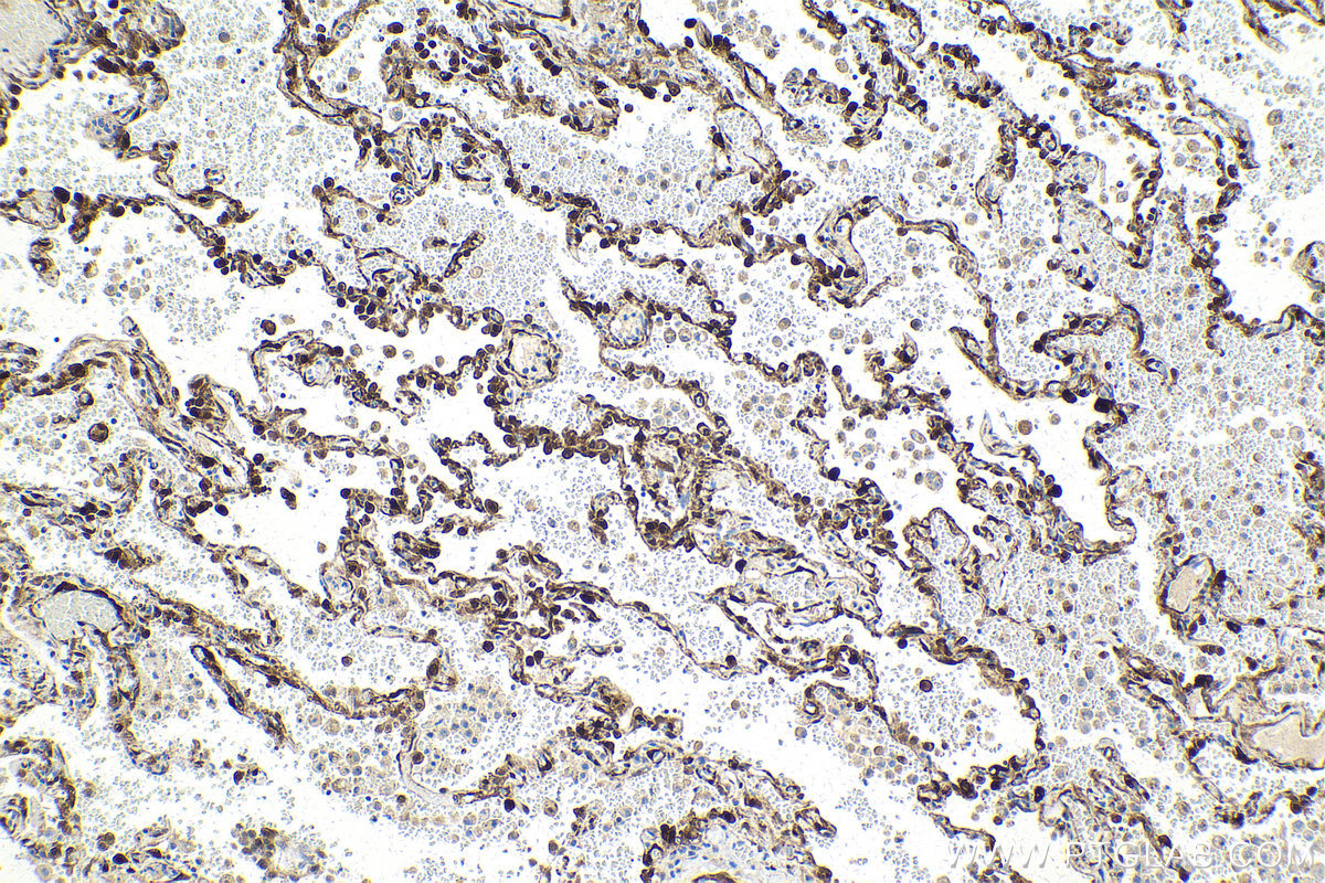 IHC staining of human lung using 68048-1-Ig