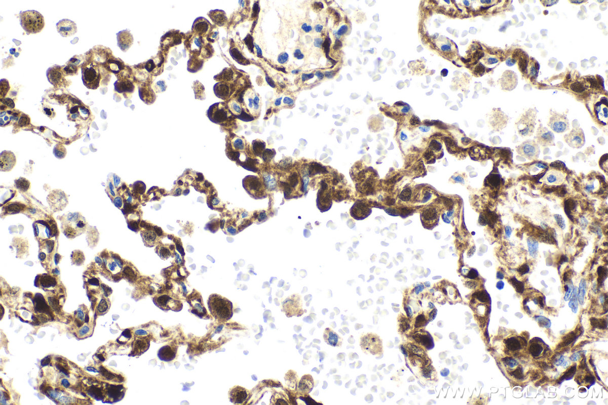 IHC staining of human lung using 68048-1-Ig