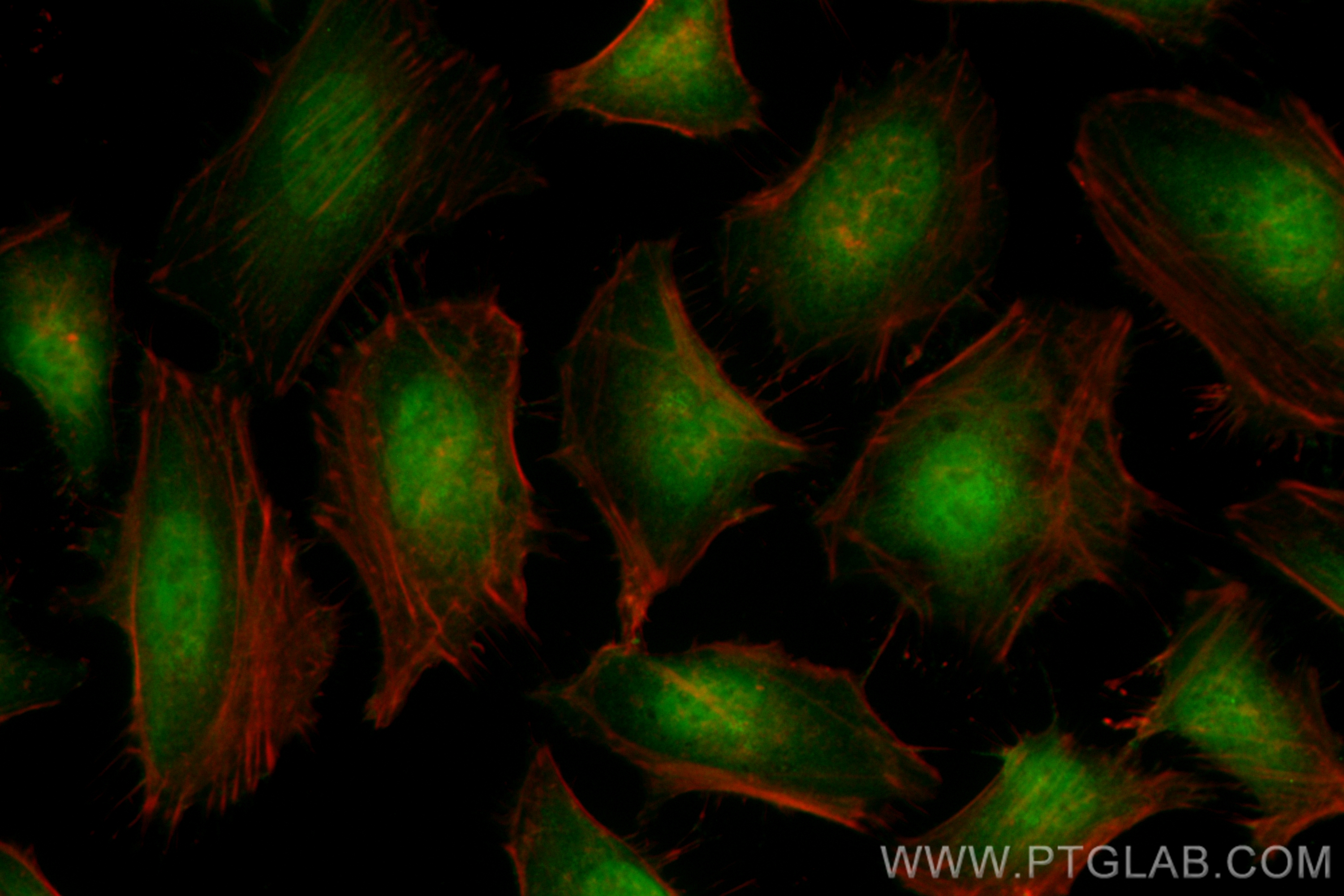 IF Staining of HeLa using CL488-83177-5