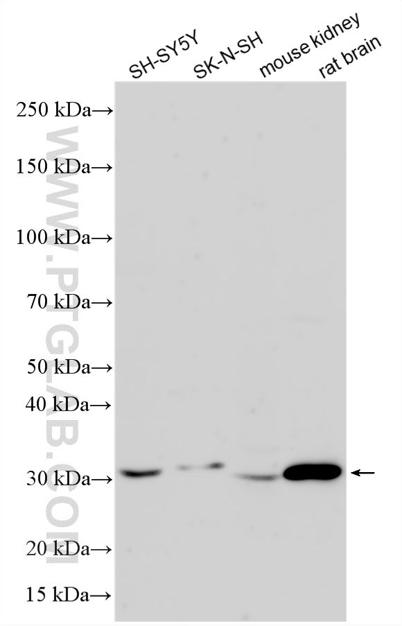 WB analysis using 33038-1-AP
