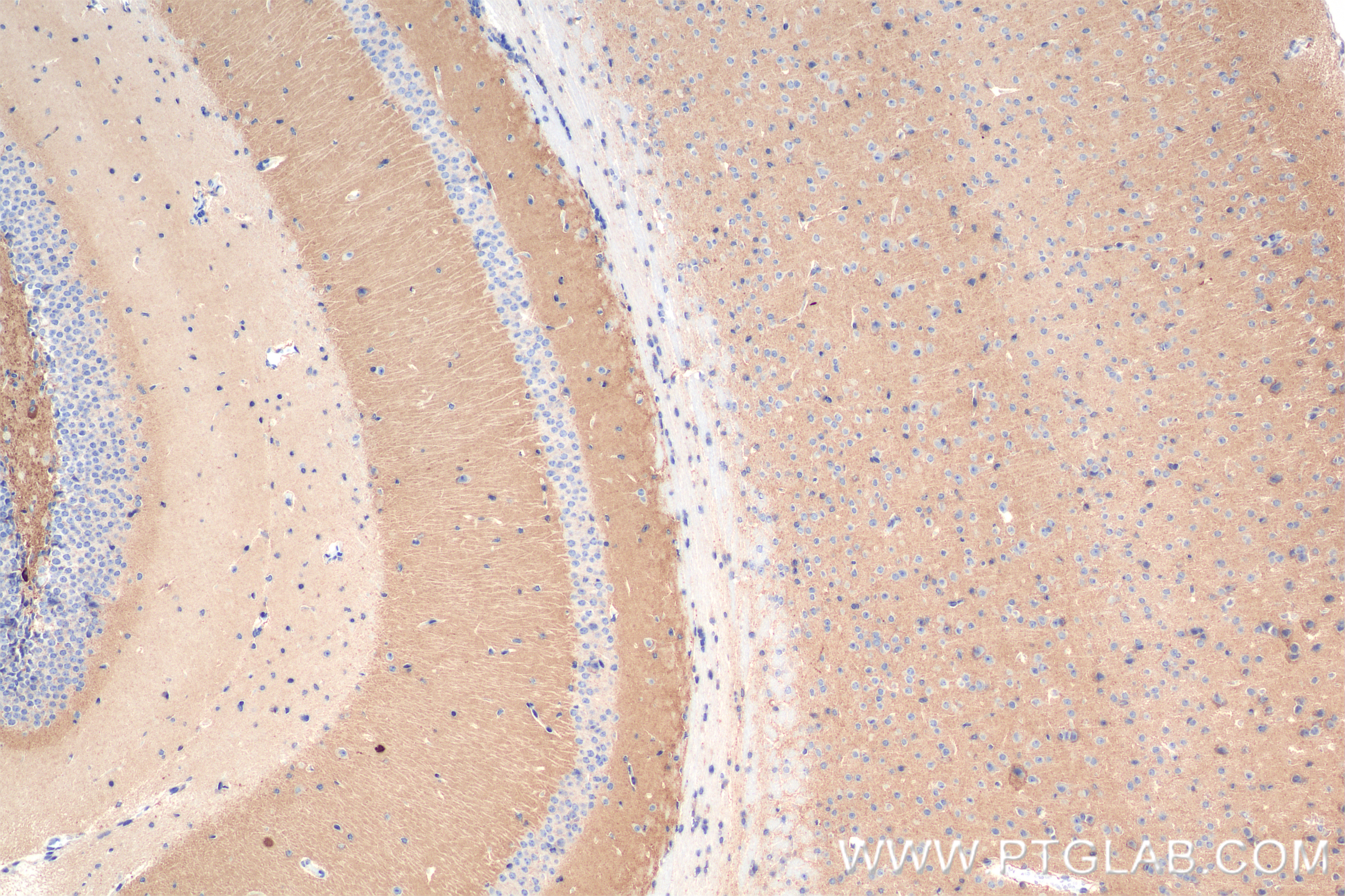 IHC staining of mouse brain using 83989-4-RR (same clone as 83989-4-PBS)