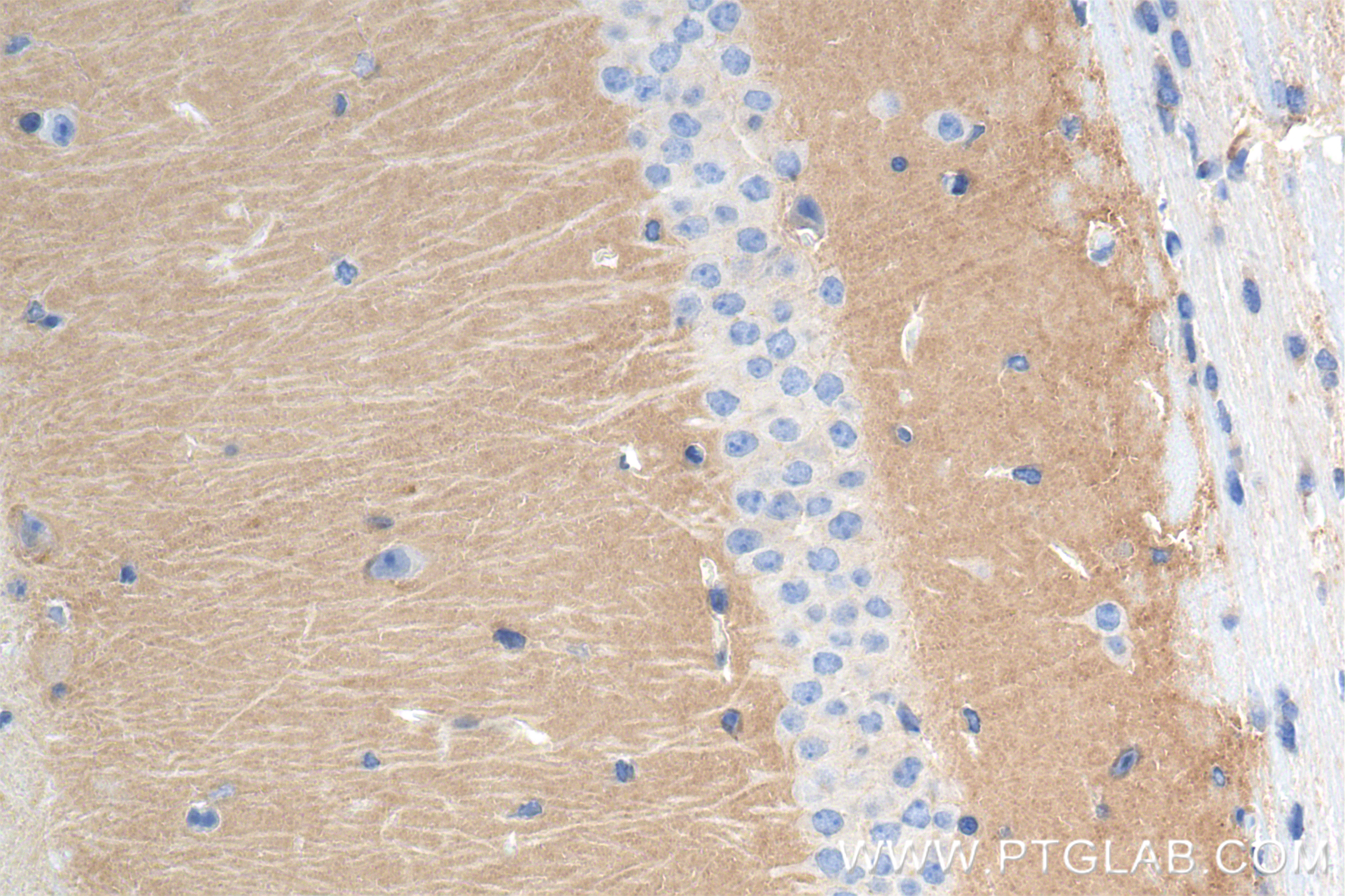 IHC staining of mouse brain using 83989-4-RR (same clone as 83989-4-PBS)