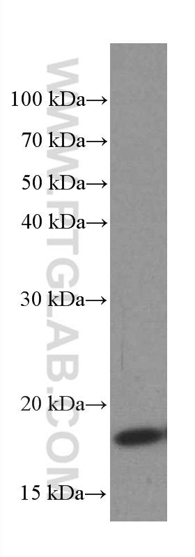 WB analysis of HeLa using 66402-1-Ig