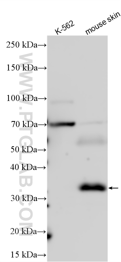WB analysis using 15332-1-AP