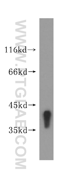 WB analysis of human liver using 11699-1-AP