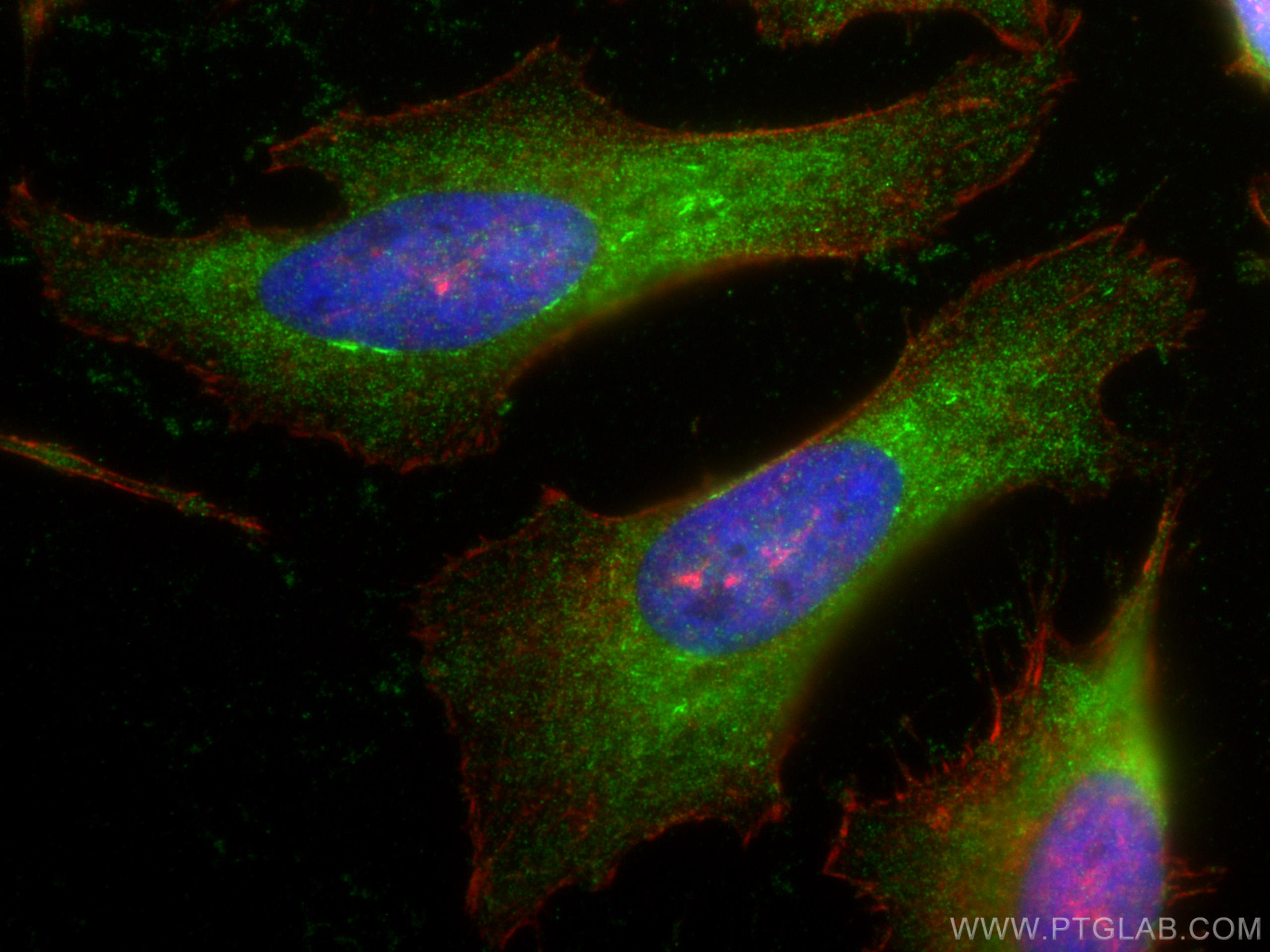 IF Staining of HeLa using 10824-1-AP