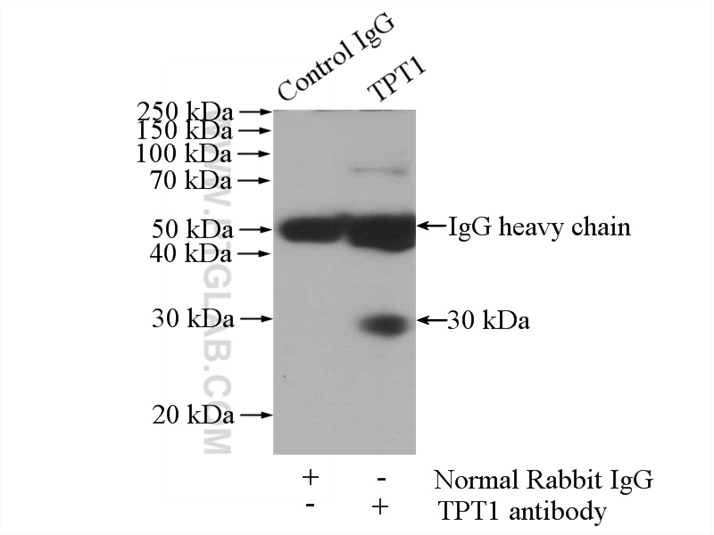 IP experiment of human placenta using 10824-1-AP