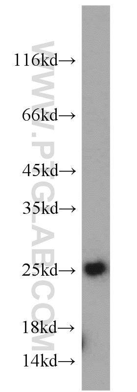 TPT1 Polyclonal antibody