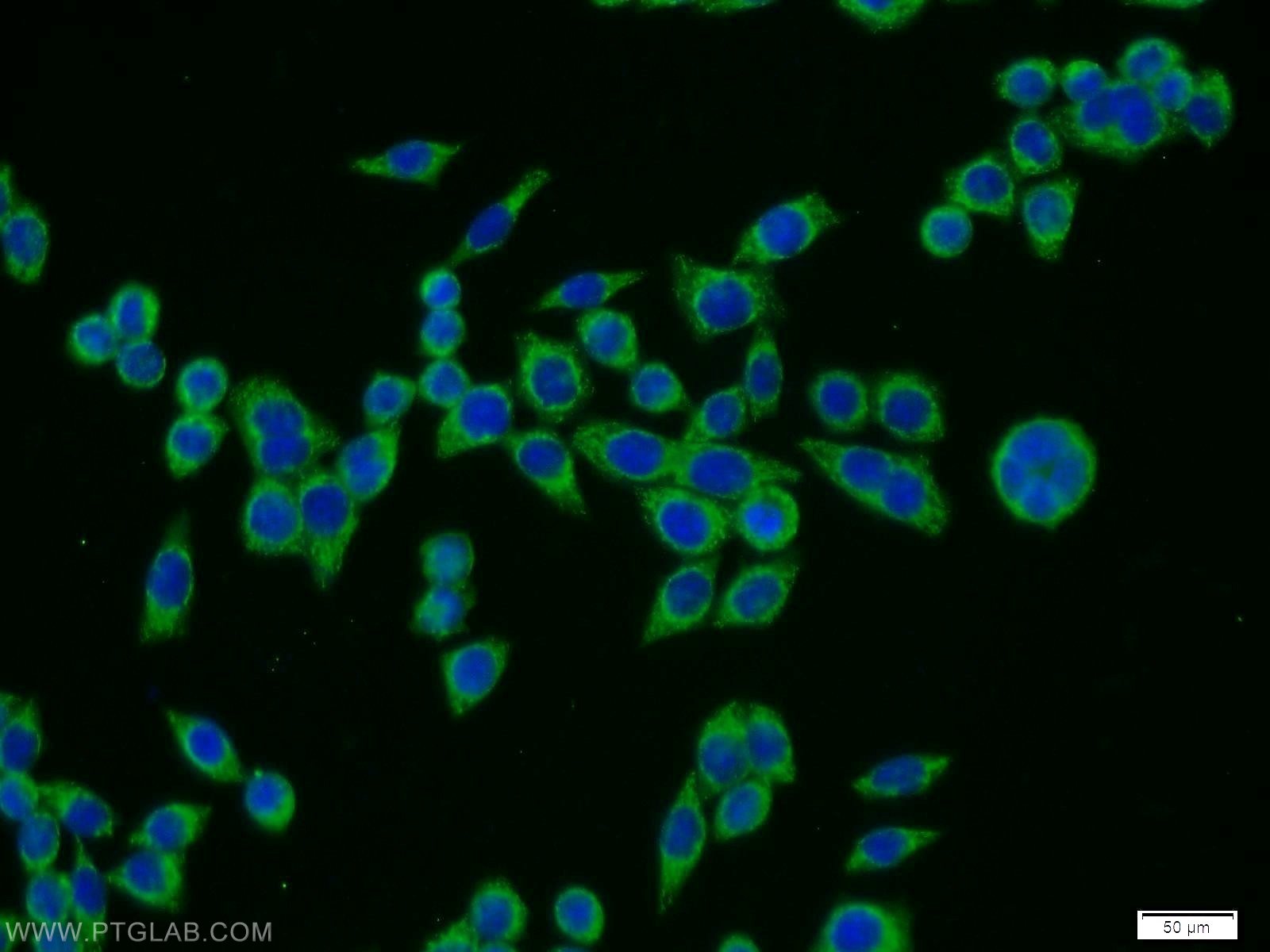 IF Staining of BxPC-3 using 12982-1-AP