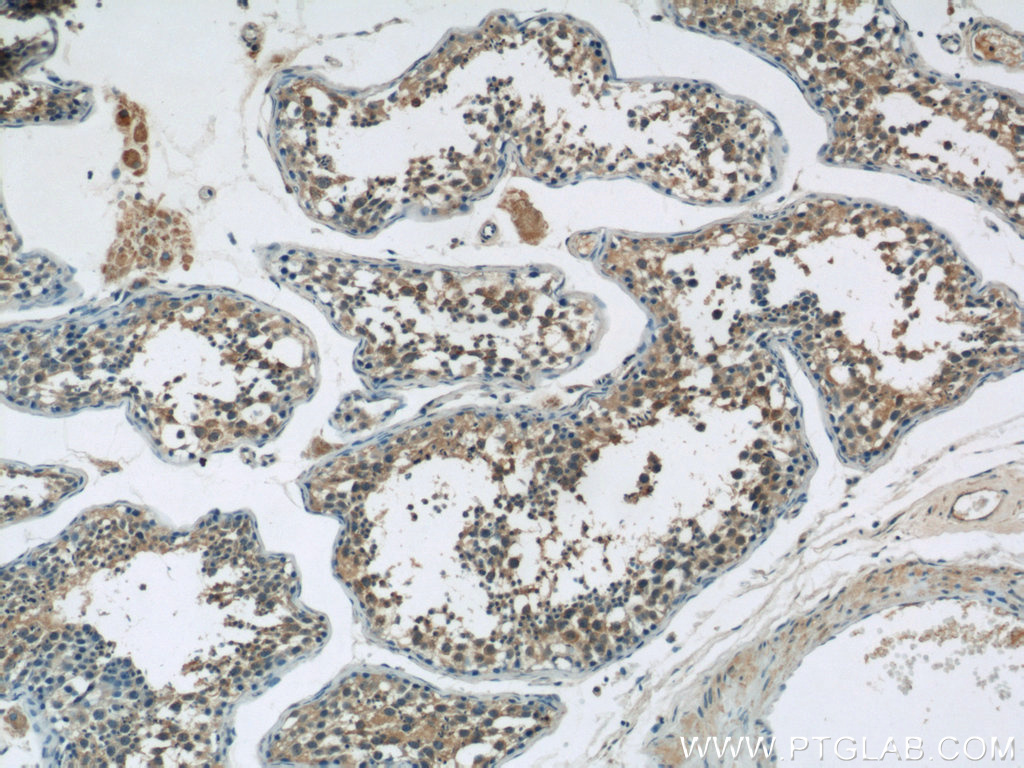 IHC staining of human testis using 12982-1-AP