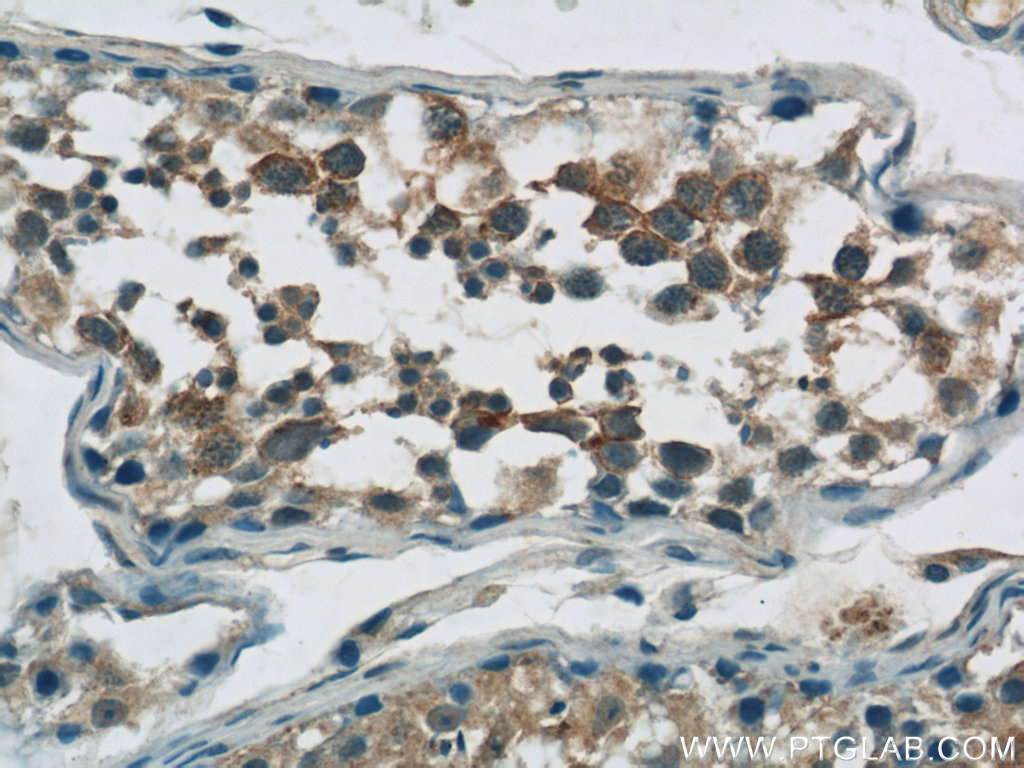 IHC staining of human testis using 12982-1-AP