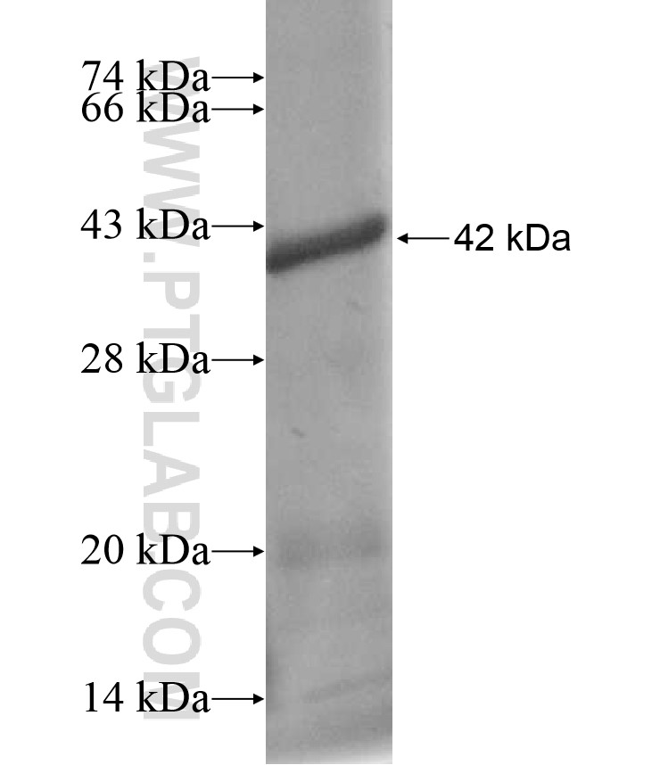 TPTE fusion protein Ag17425 SDS-PAGE