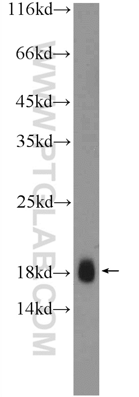 WB analysis of HeLa using 25753-1-AP