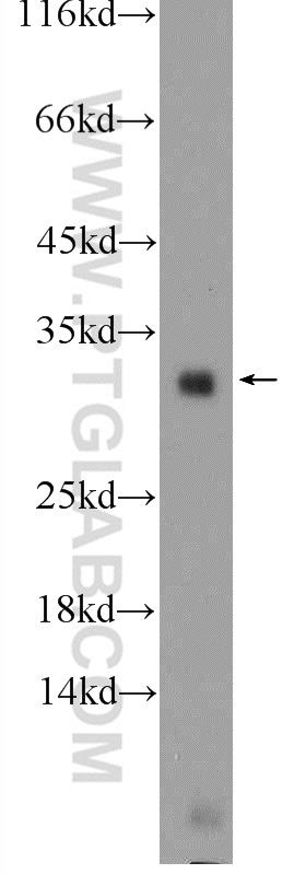 TRA2B Polyclonal antibody