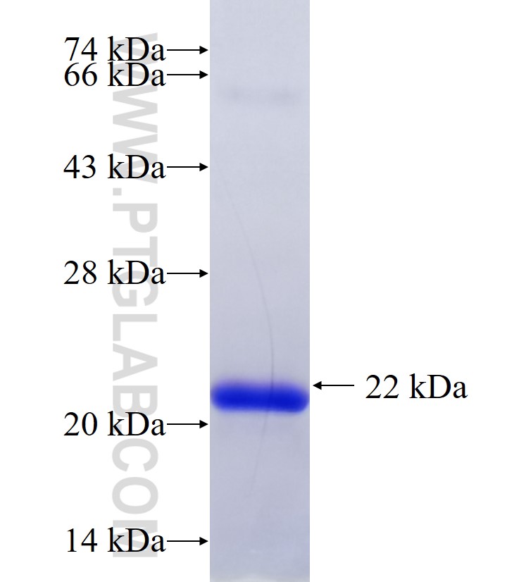 TRABD2A fusion protein Ag30271 SDS-PAGE