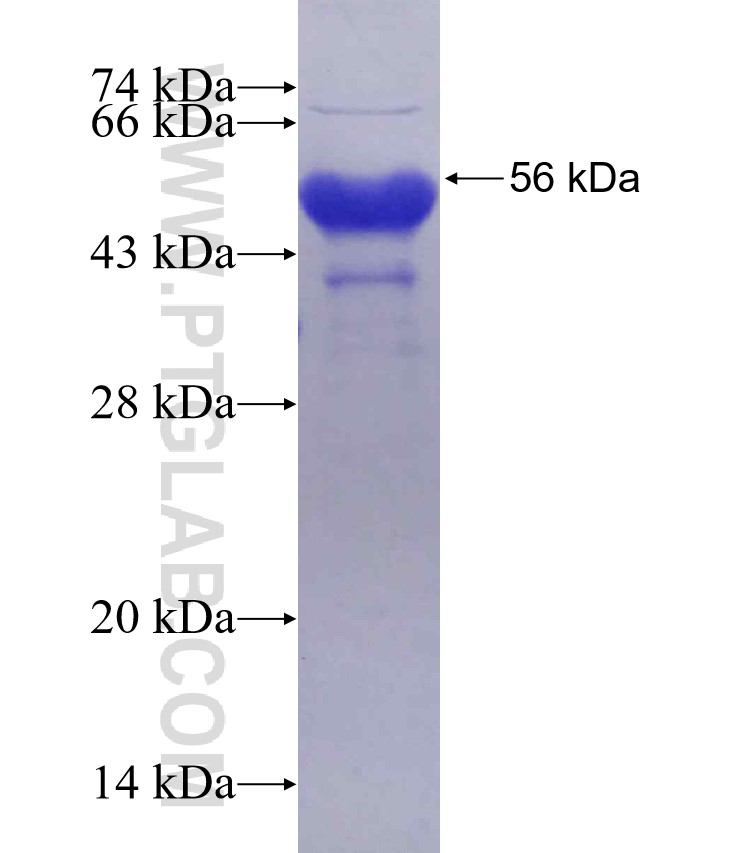 TRABD2B fusion protein Ag30248 SDS-PAGE