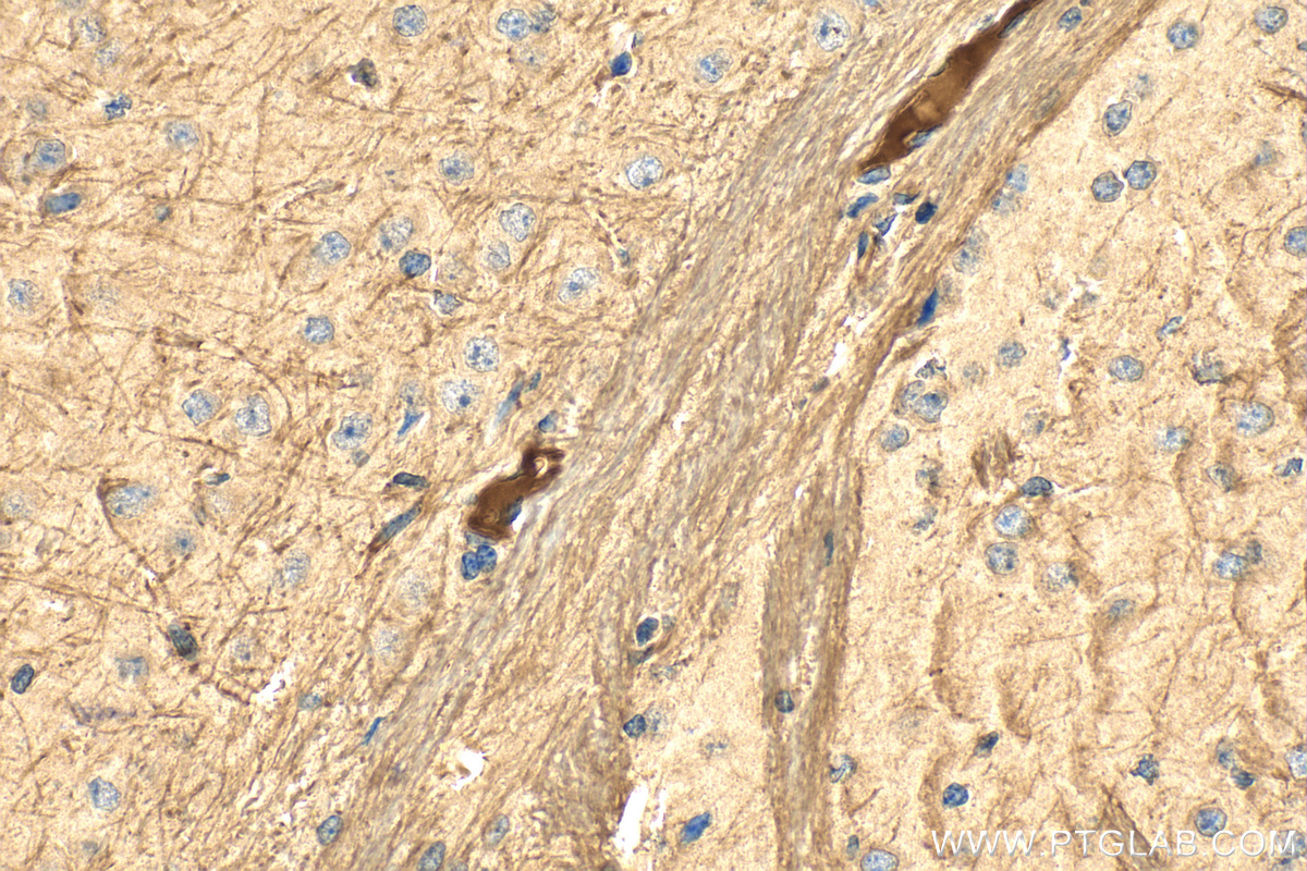 Immunohistochemical analysis of paraffin-embedded mouse brain tissue slide using <a class='green' href='/productredirect?CatalogNo=15468-1-AP' target='_blank'>15468-1-AP</a> (TRADD antibody) at dilution of 1:100 (under 40x lens). Heat mediated antigen retrieval with Tris-EDTA buffer (pH 9.0). This data was developed using the same antibody clone with 15468-1-PBS in a different storage buffer formulation. IHC staining of mouse brain using 15468-1-AP (same clone as 15468-1-PBS)