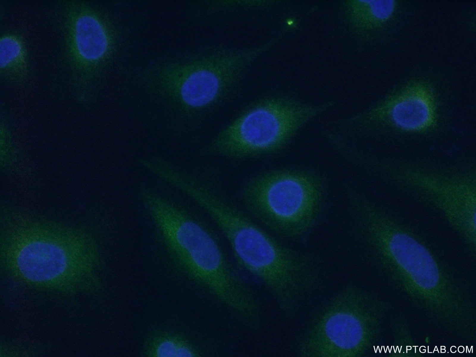 IF Staining of HUVEC using 26845-1-AP