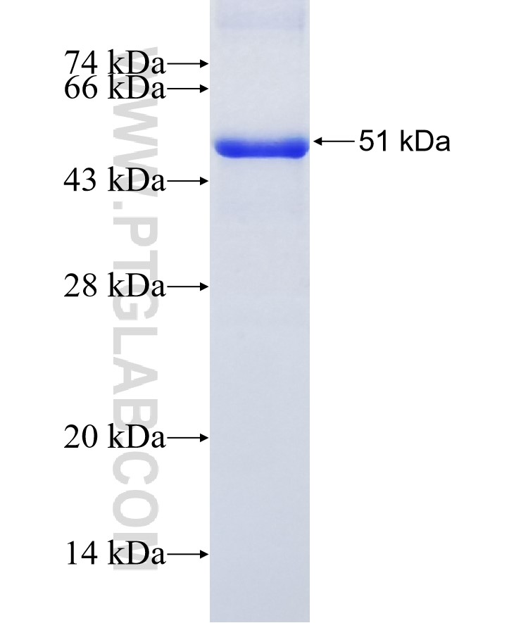 TRAF1 fusion protein Ag23957 SDS-PAGE TRAF1 fusion protein Ag23957 SDS-PAGE