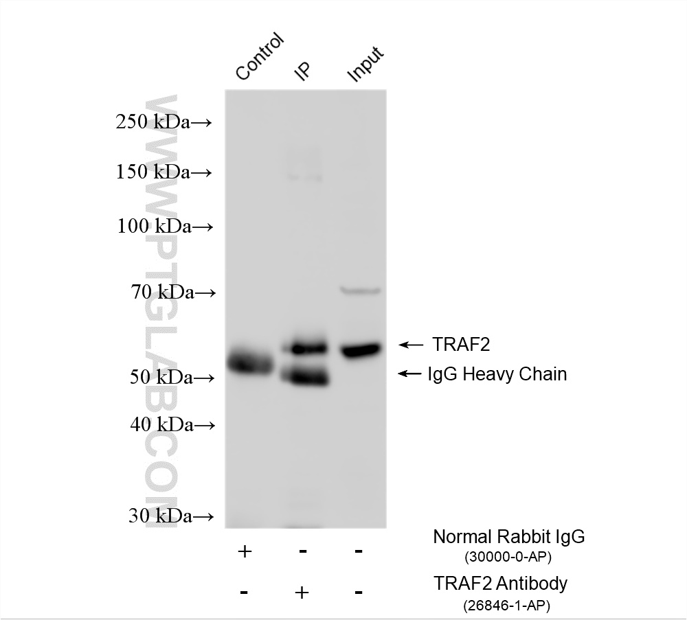 IP experiment of HeLa using 26846-1-AP