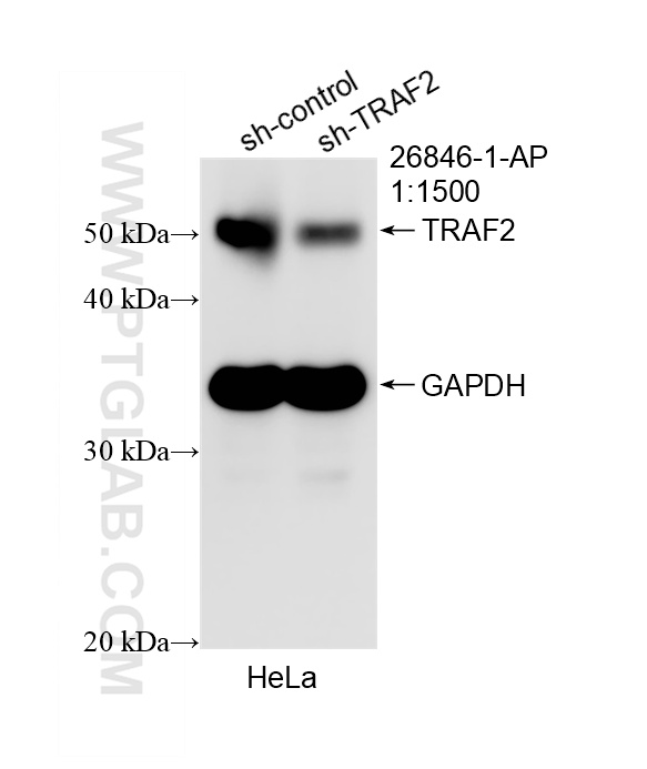 WB analysis of HeLa using 26846-1-AP
