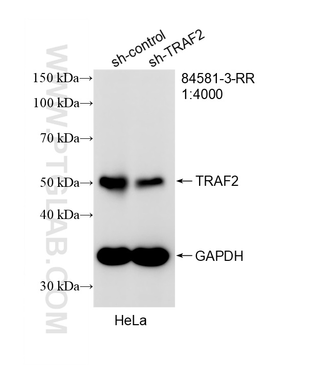 WB analysis of HeLa using 84581-3-RR