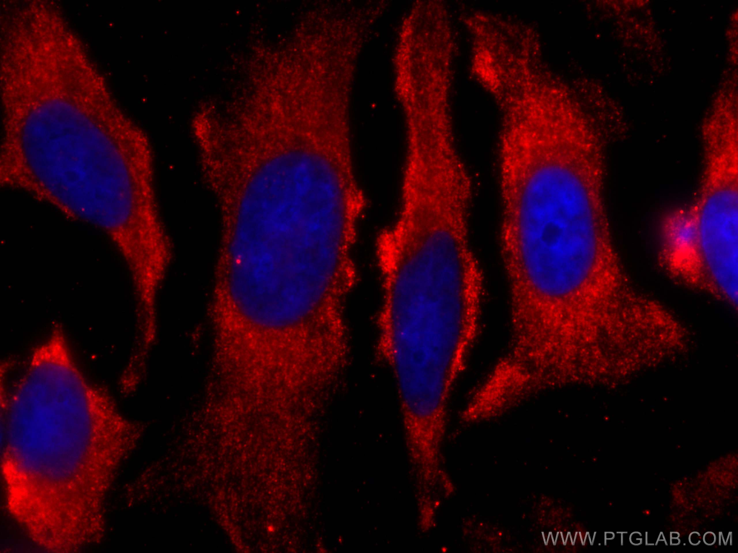 IF Staining of HeLa using CL594-67315