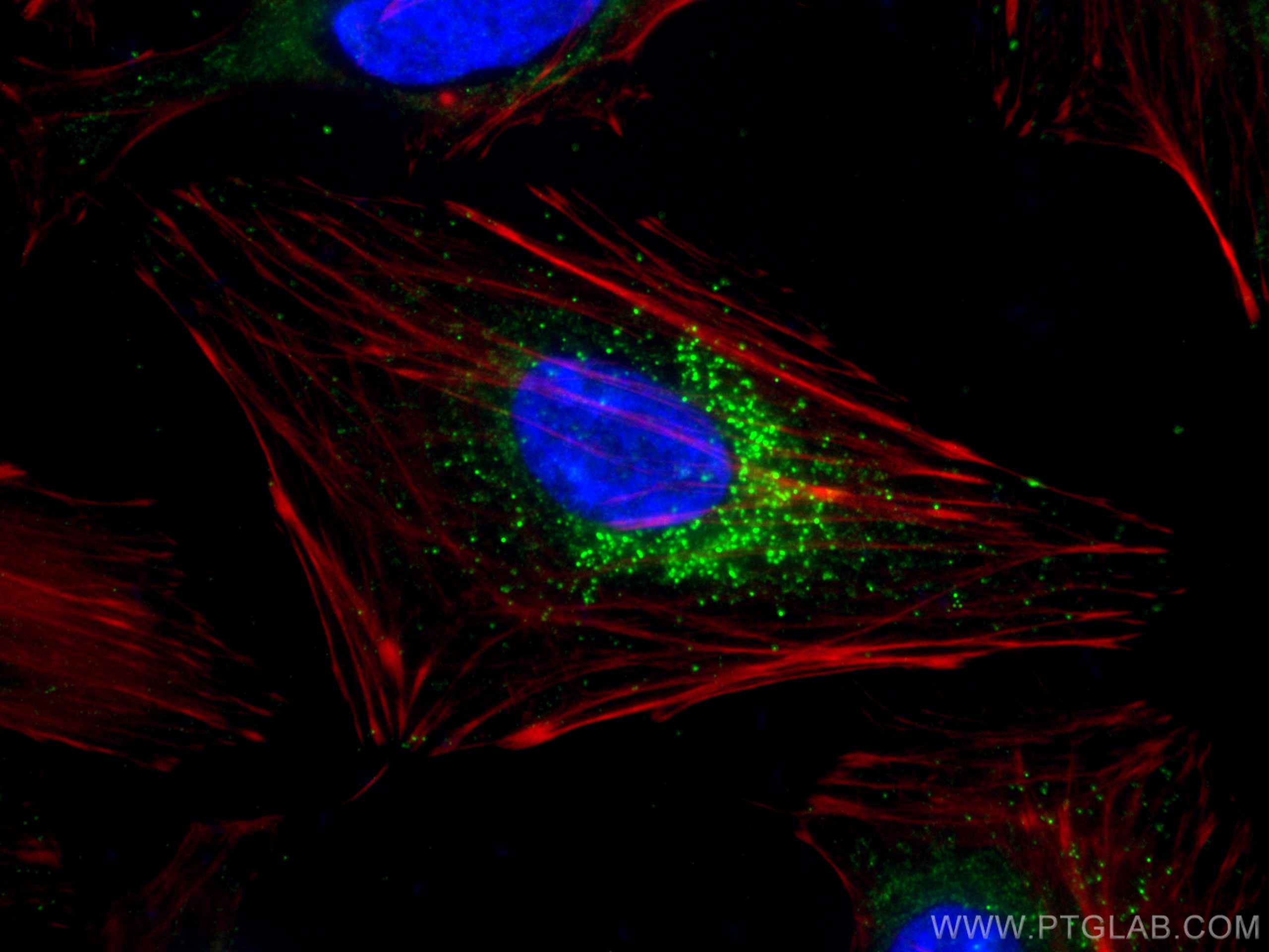 IF Staining of HeLa using 66310-1-Ig