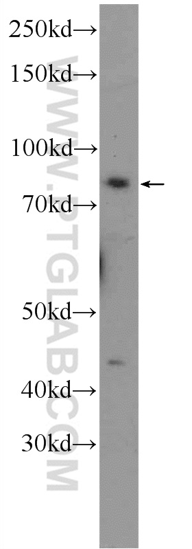 WB analysis of HEK-293 using 14404-1-AP