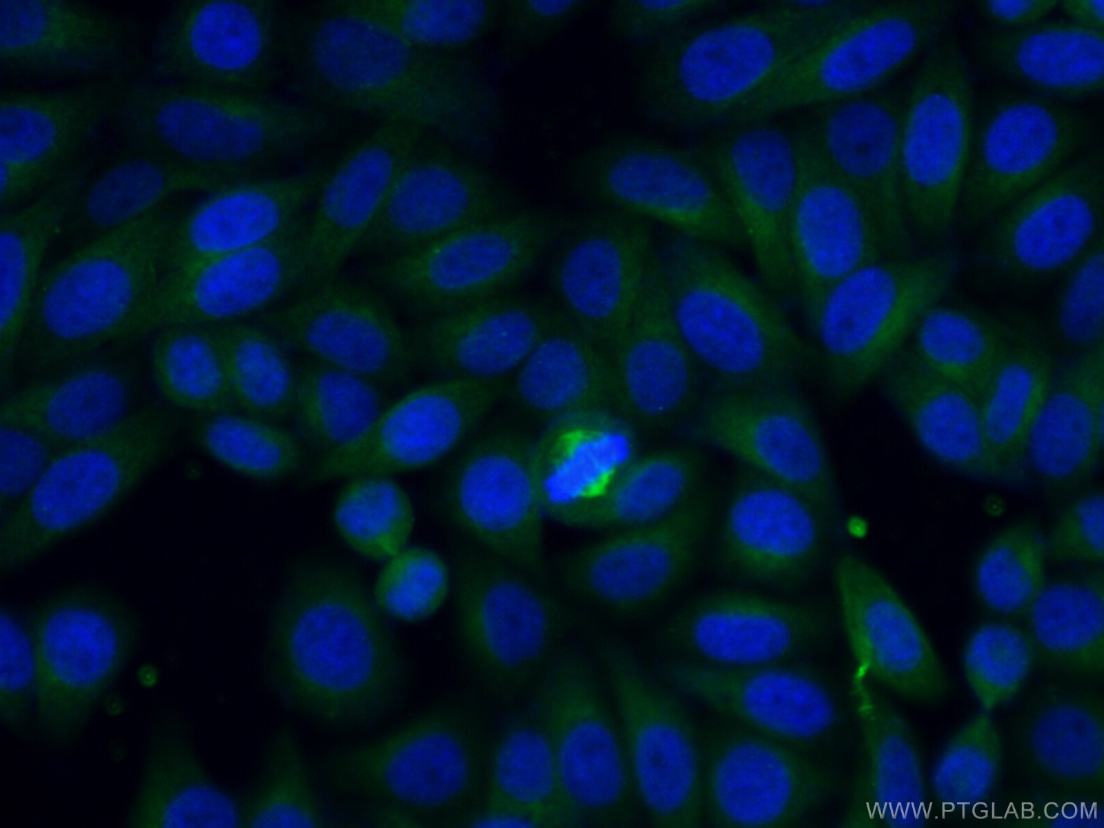 IF Staining of HepG2 using 26692-1-AP