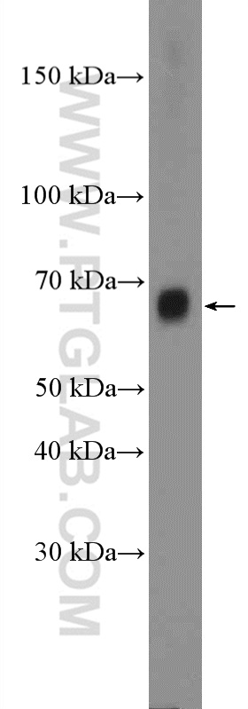 WB analysis of MCF-7 using 26692-1-AP