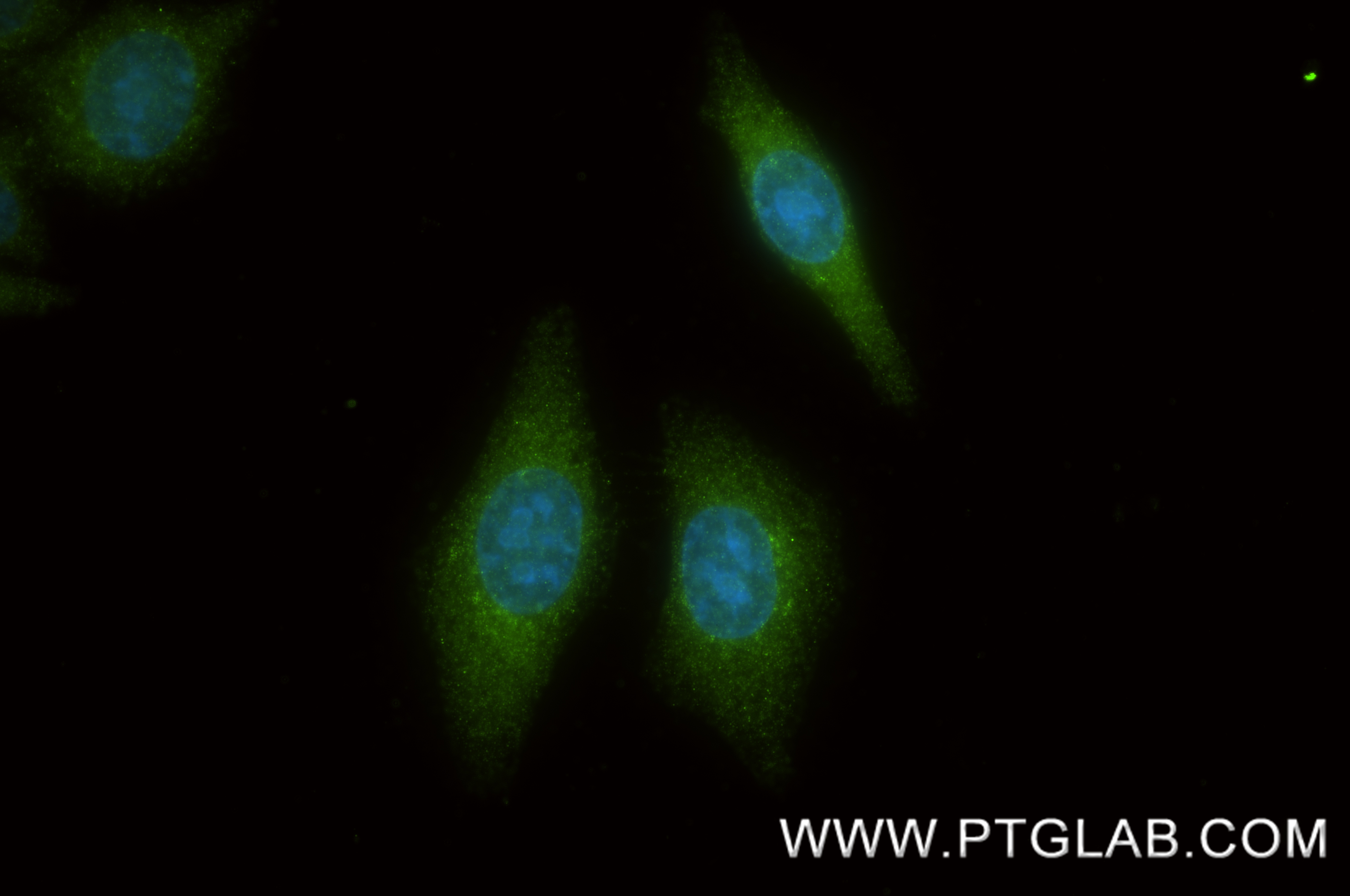 IF Staining of HepG2 using 87596-1-RR (same clone as 87596-1-PBS)