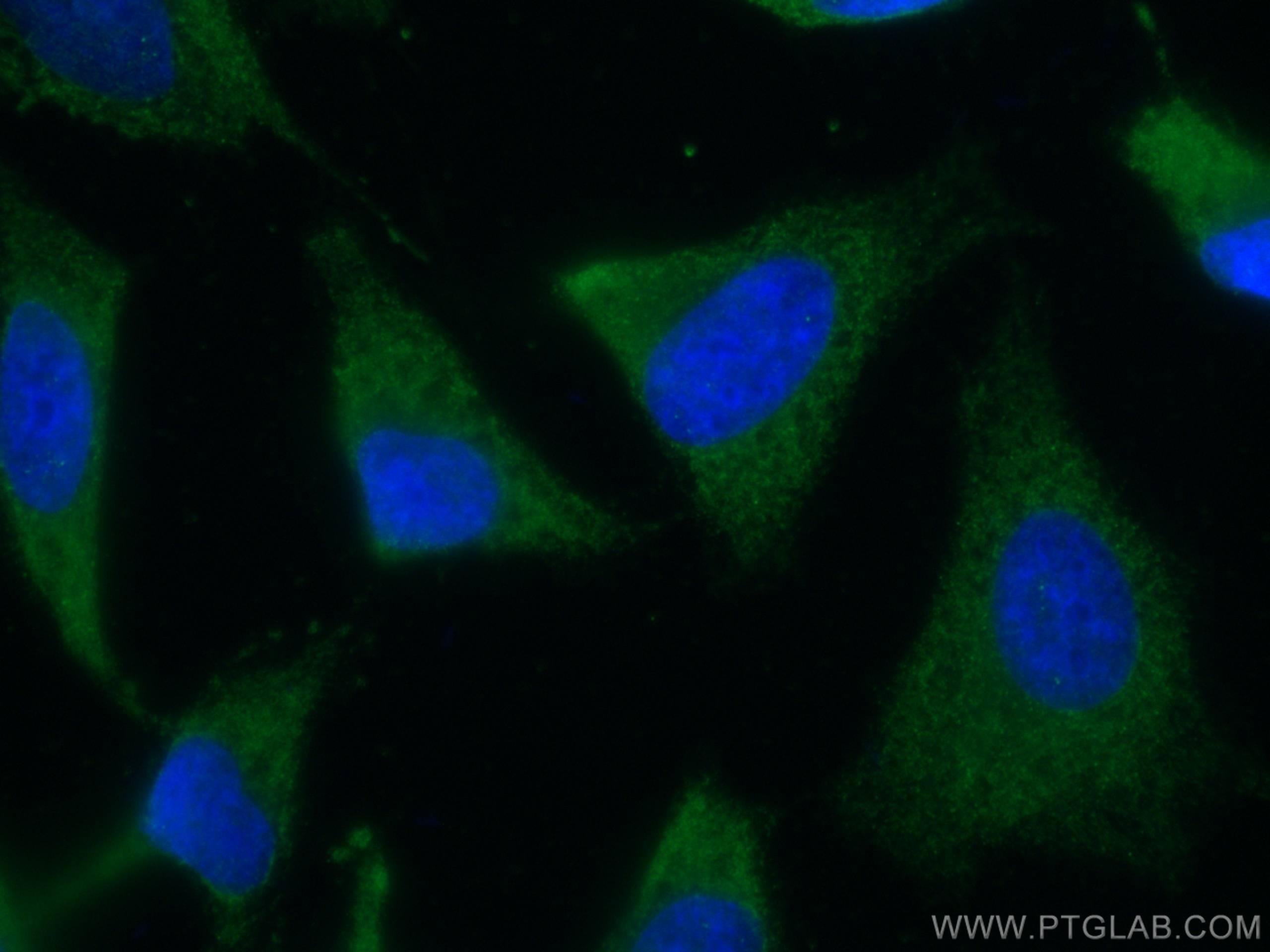 IF Staining of HeLa using 66498-1-Ig