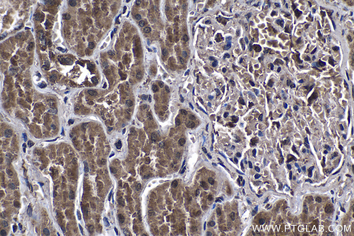 IHC staining of human kidney using 66498-1-Ig IHC staining of human kidney using 66498-1-Ig
