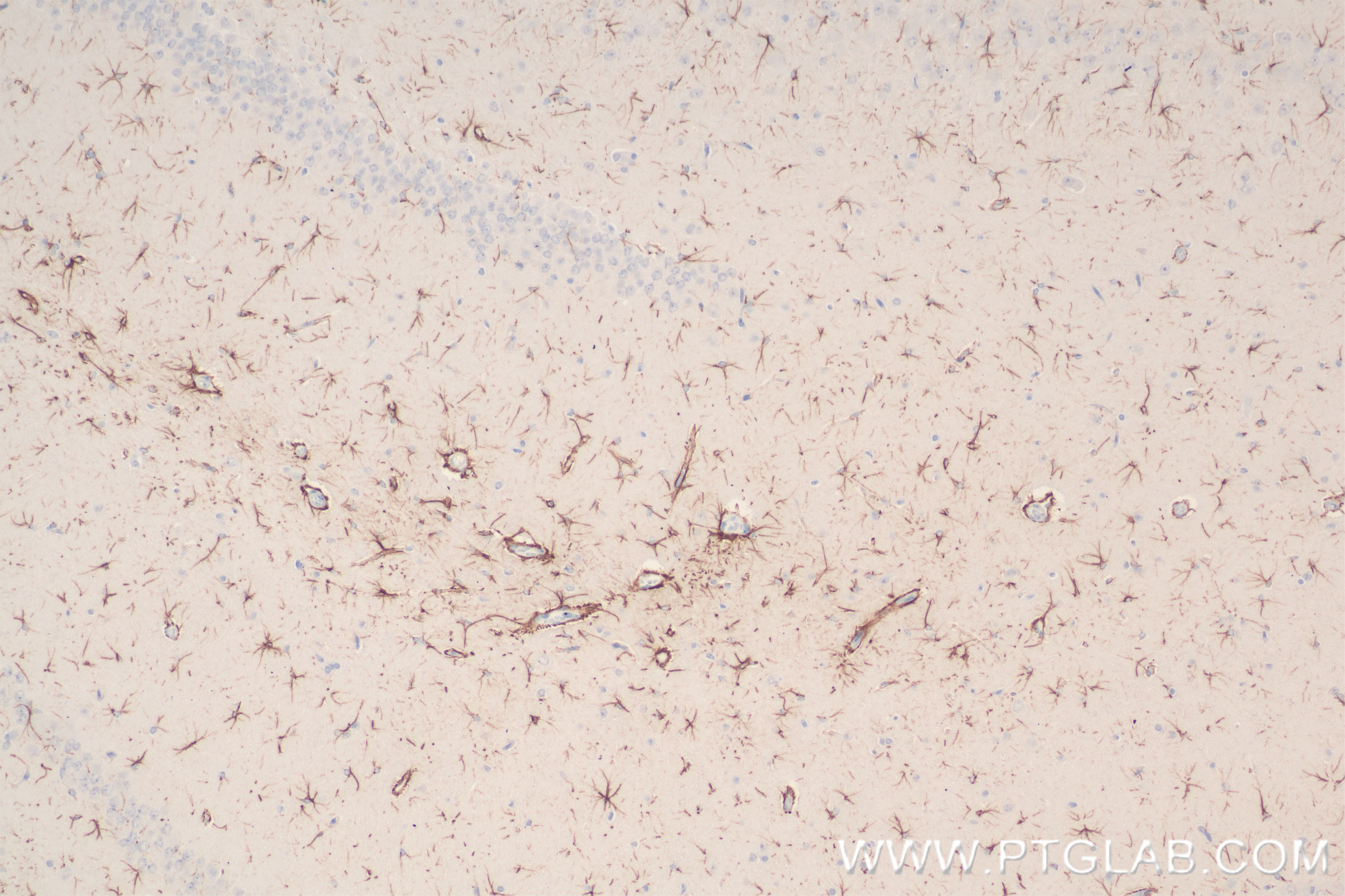 IHC staining of rat brain using 83535-2-RR