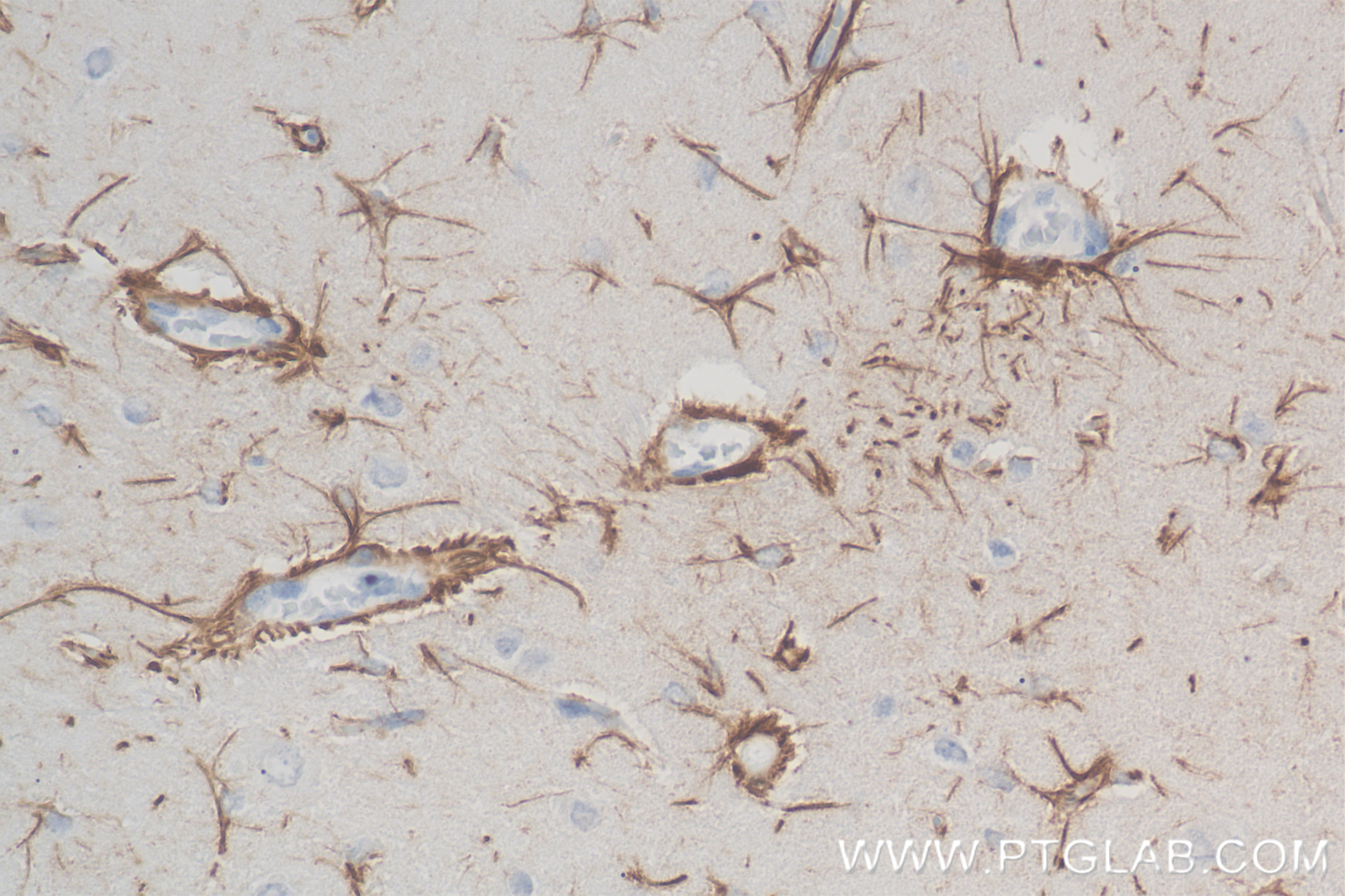 IHC staining of rat brain using 83535-2-RR