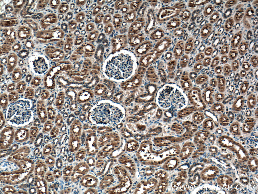 IHC staining of human kidney using 27064-1-AP