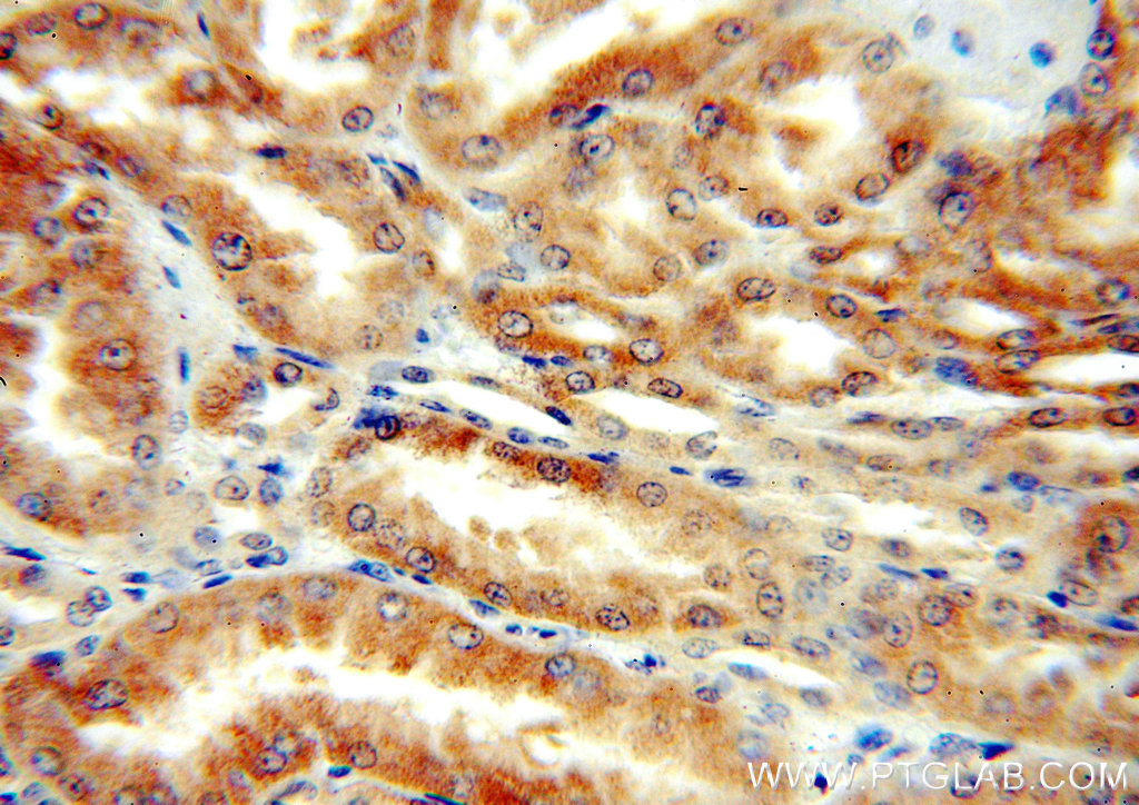 IHC staining of human kidney using 16781-1-AP