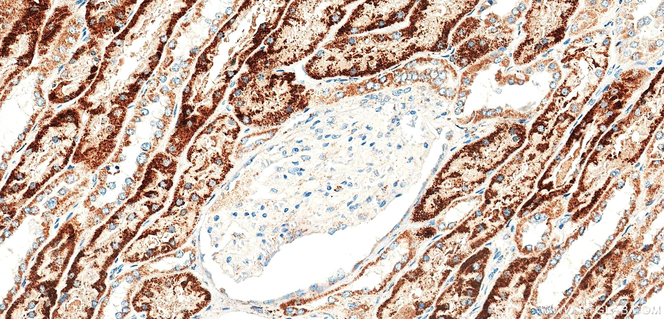 IHC staining of human kidney using 85425-2-RR (same clone as 85425-2-PBS)