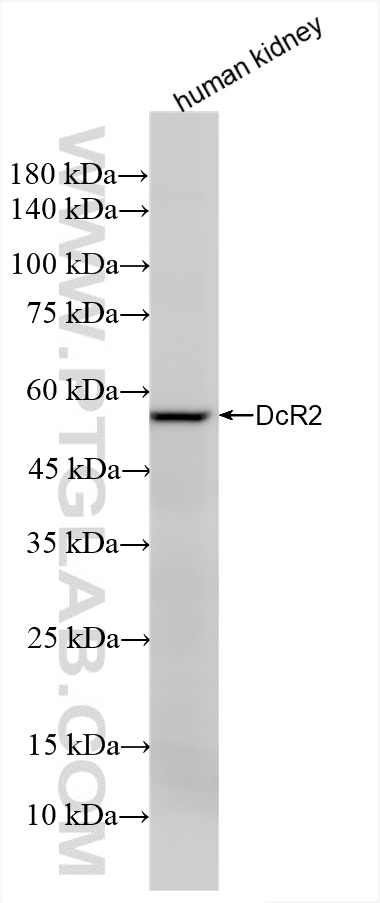 WB analysis using 85425-2-RR