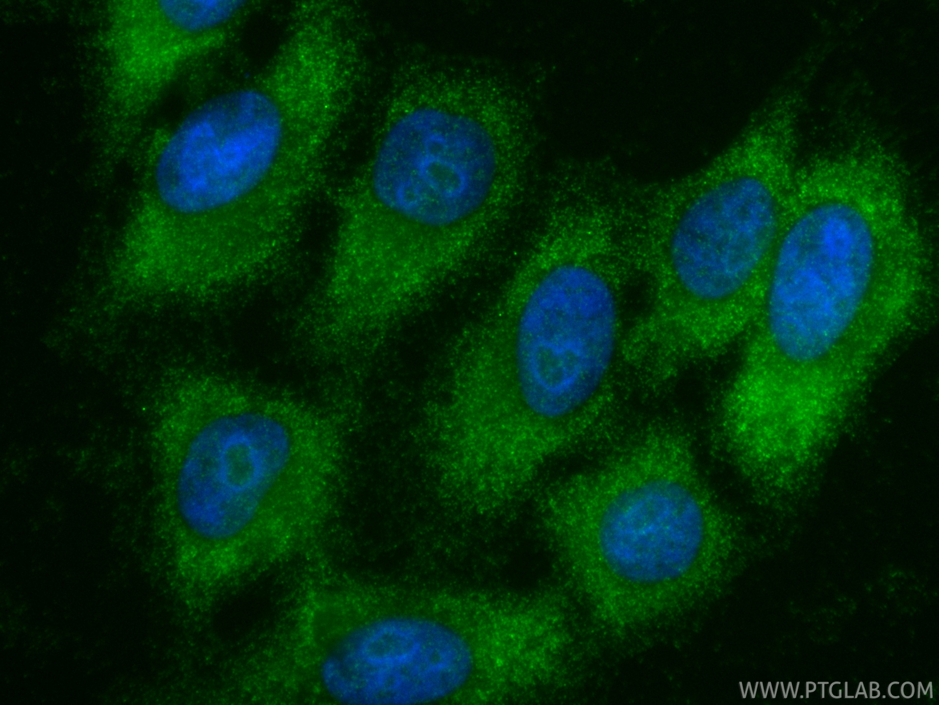 IF Staining of HepG2 using 10332-1-AP