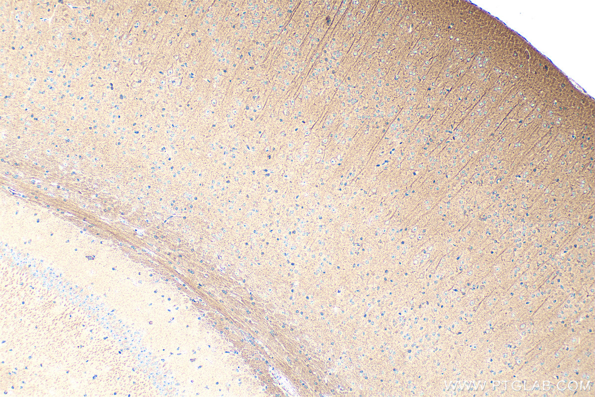 IHC staining of mouse brain using 10332-1-AP