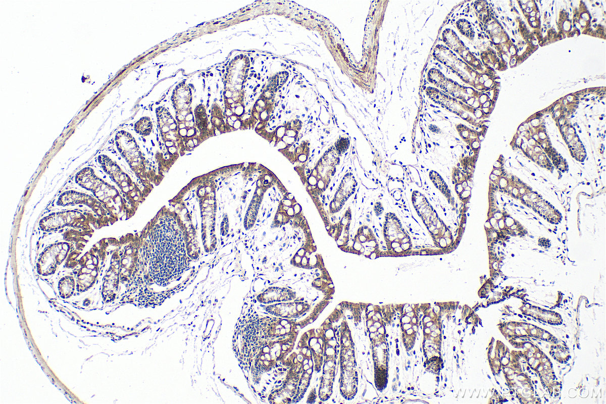 IHC staining of mouse colon using 10332-1-AP