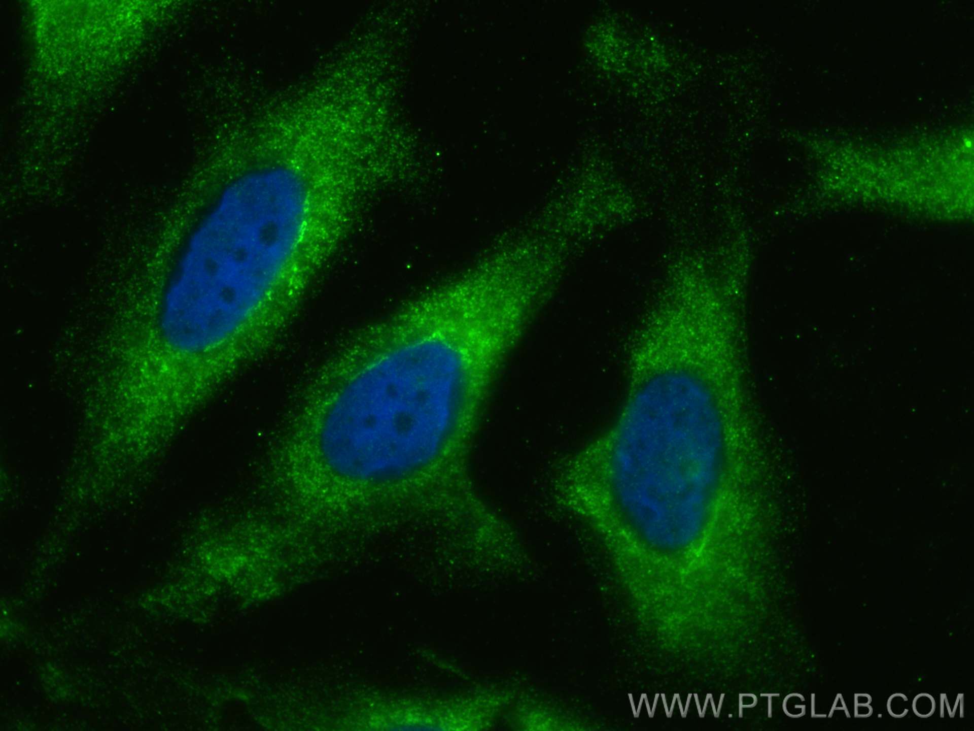 IF Staining of HeLa using 13770-1-AP