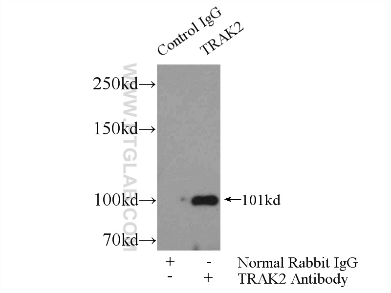 IP experiment of HepG2 using 13770-1-AP