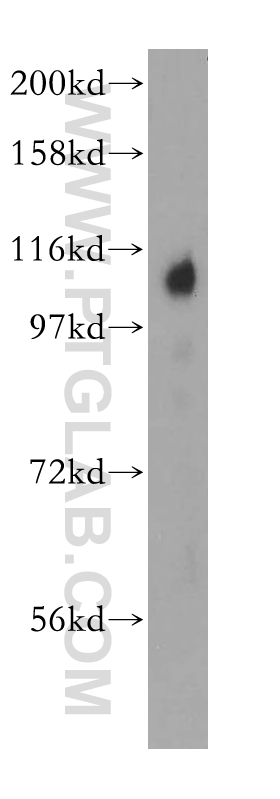 WB analysis of human liver using 13770-1-AP